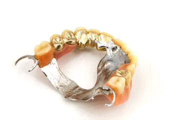 Zahngold in Zahnprothese