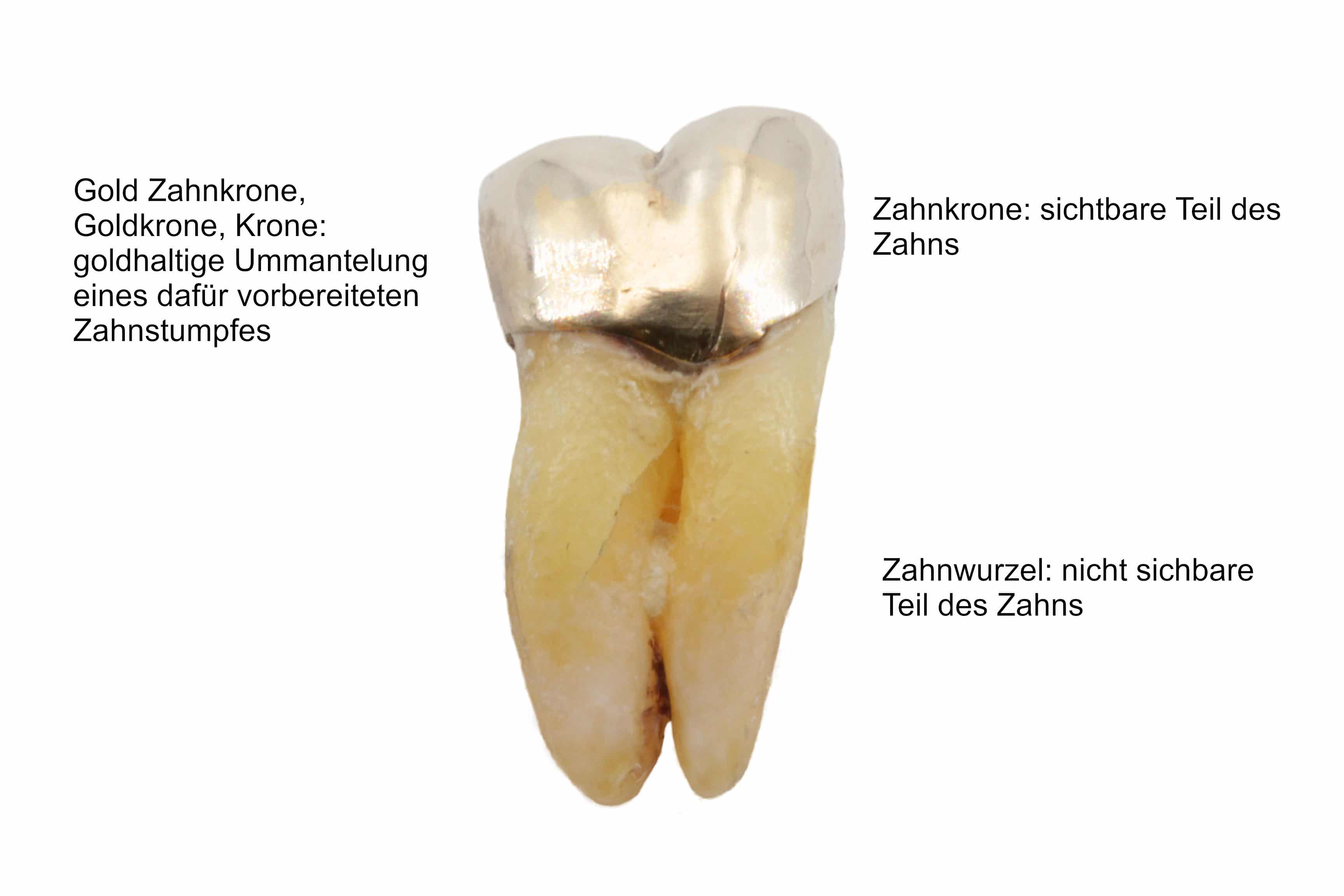 Zahn Hintergrund weiß mit Beschriftung