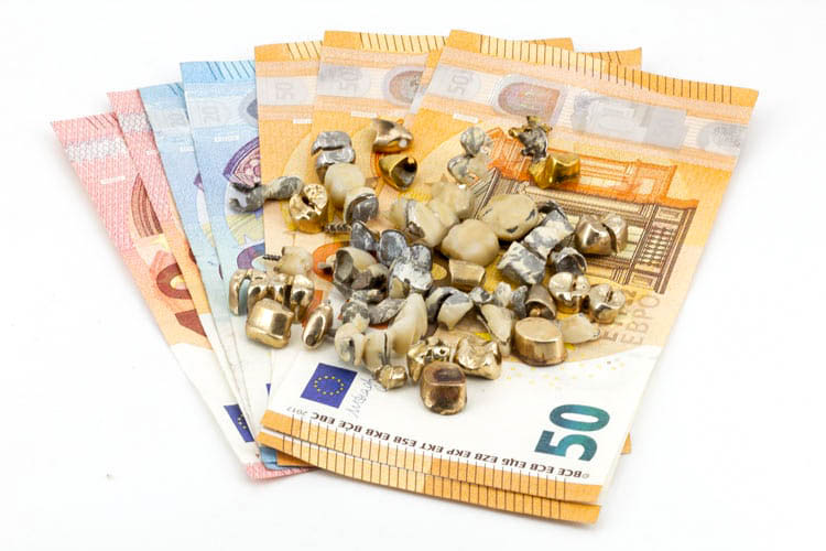 Zahngold mit Zahn Rechner